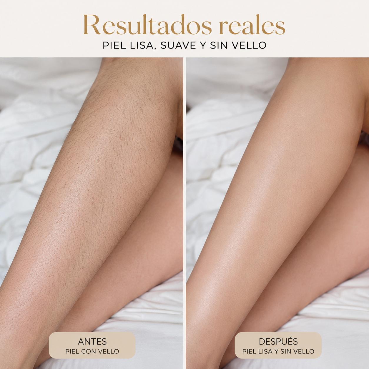 Hair Removal™ — La Forma Inteligente de Conseguir una Piel Perfecta